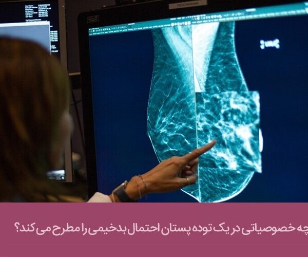 تشخیص تومورهای بدخیم از خوش‌خیم در سرطان سینه