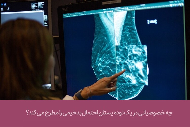 تشخیص تومورهای بدخیم از خوش‌خیم در سرطان سینه