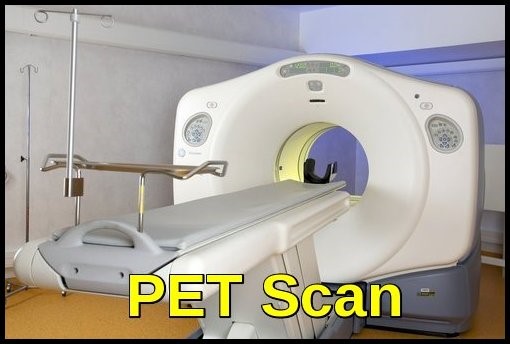 PET Scan چیست؟